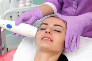 microneedling procedure