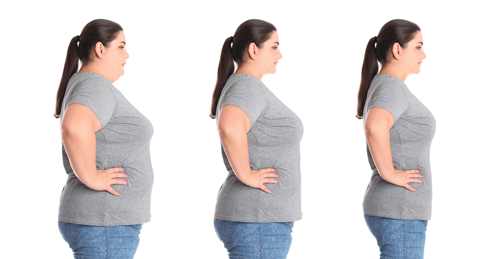 Three stages of transformation during medical weight loss.