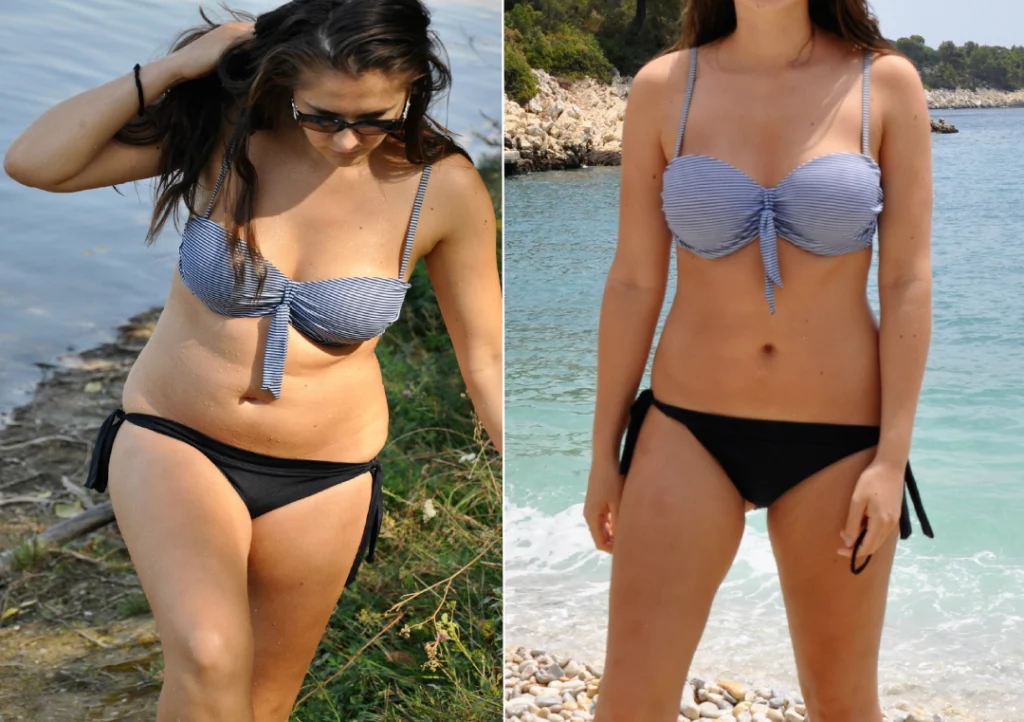 Before and after comparison showing a woman's body transformation with medical weight loss.