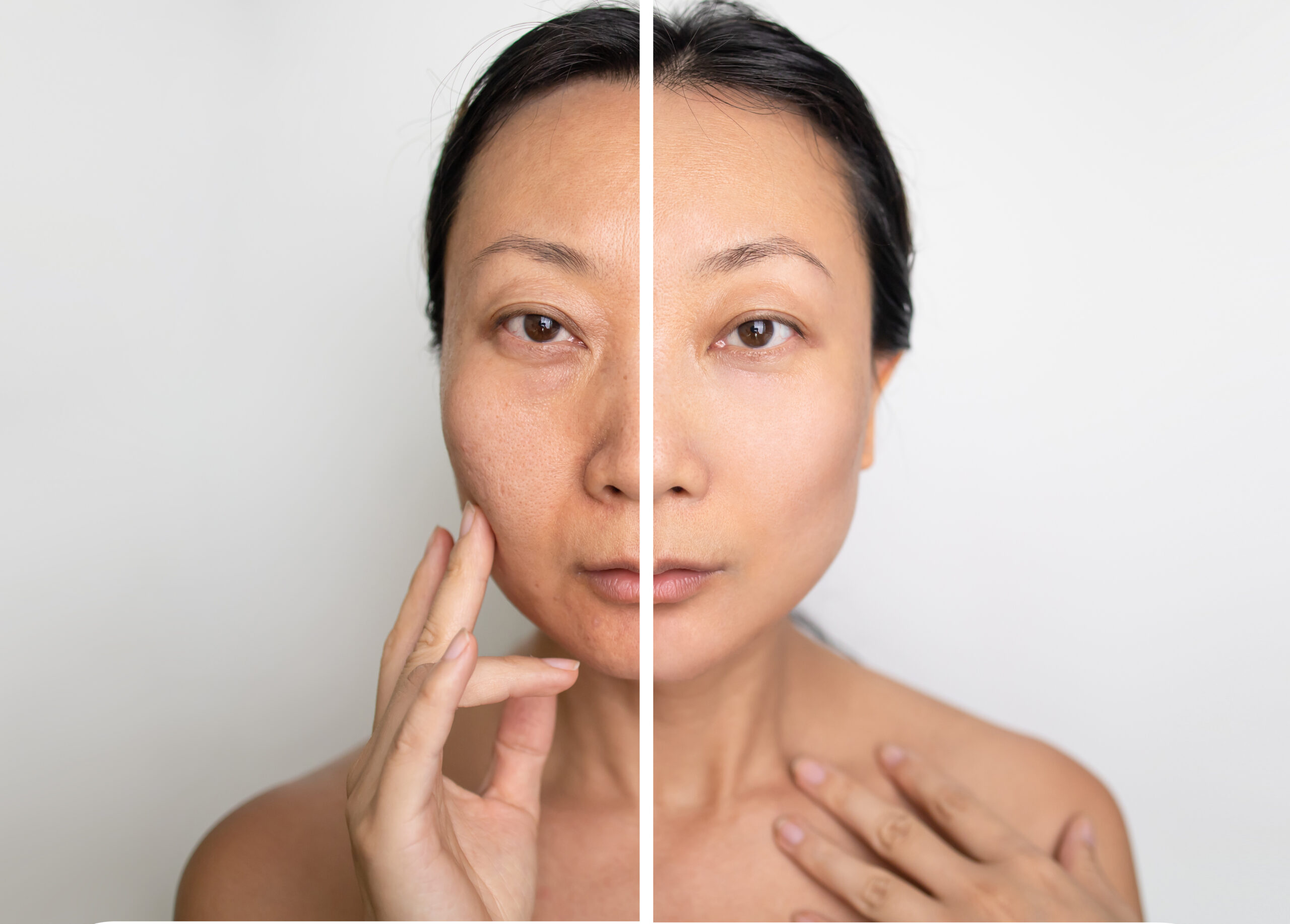 A woman’s face shown in left and right images side by side, with visible differences in coloration and texture across the two halves.