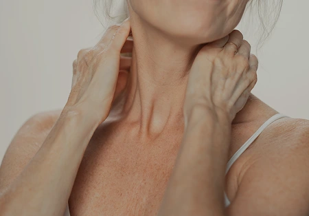 Neck and jawline lifting treatment at Amy Chow, MD Rejuvenation Practice in Lee's Summit, MO